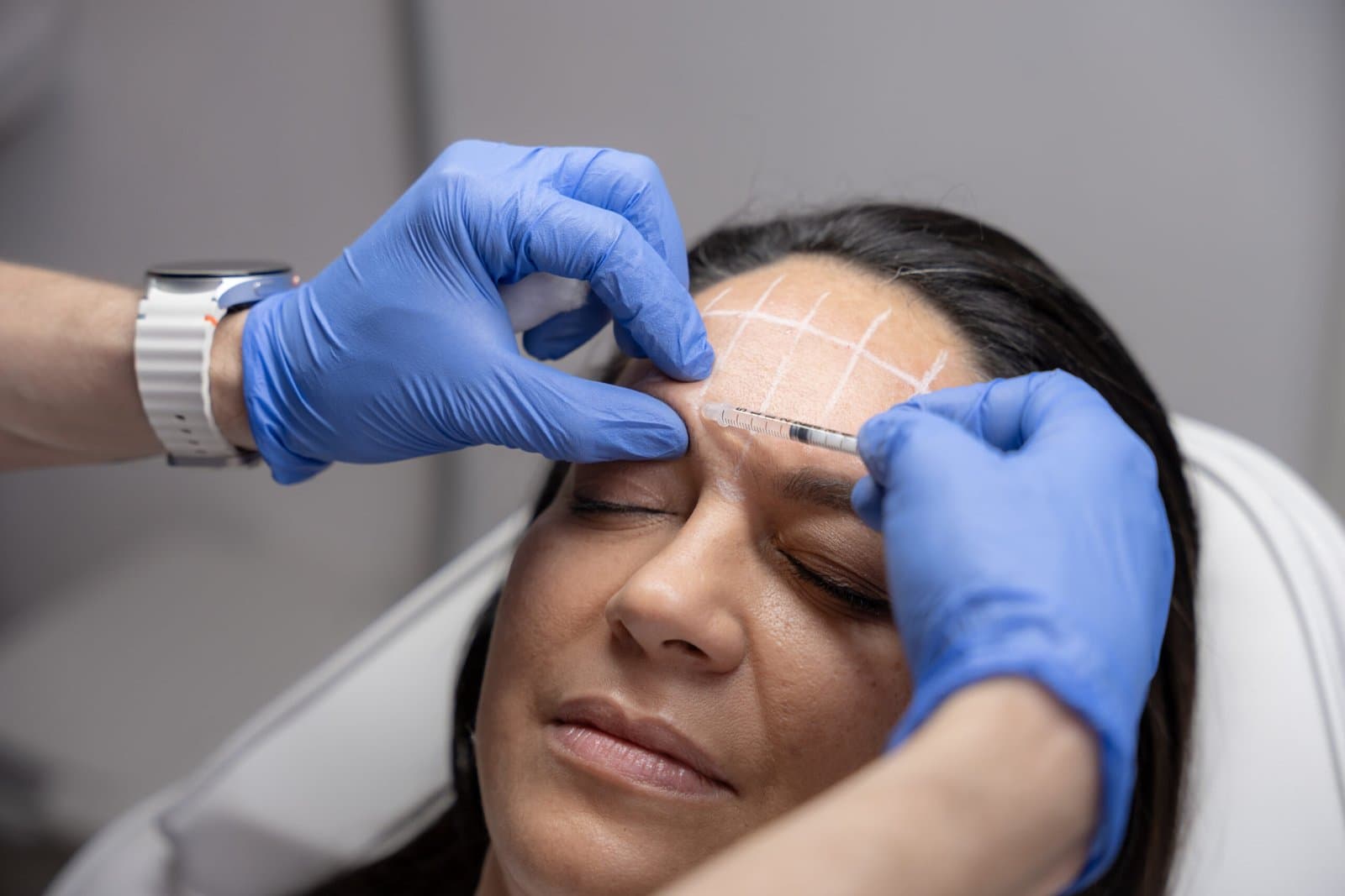 Armonización facial con criterio: proporciones, soporte y calidad del tejido más allá de rellenar